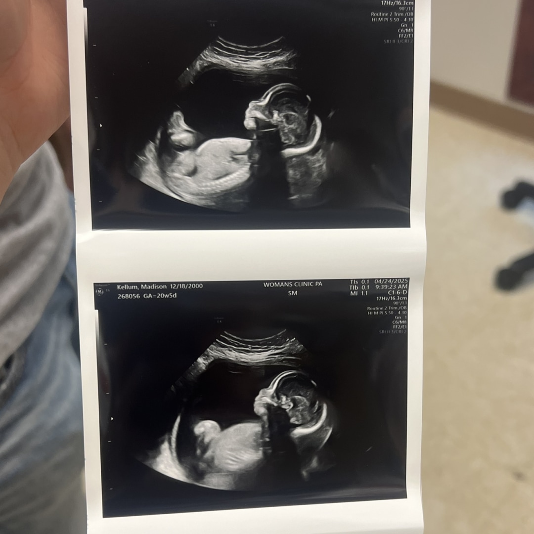 Photo shared by Madison for their Babylist baby registry.