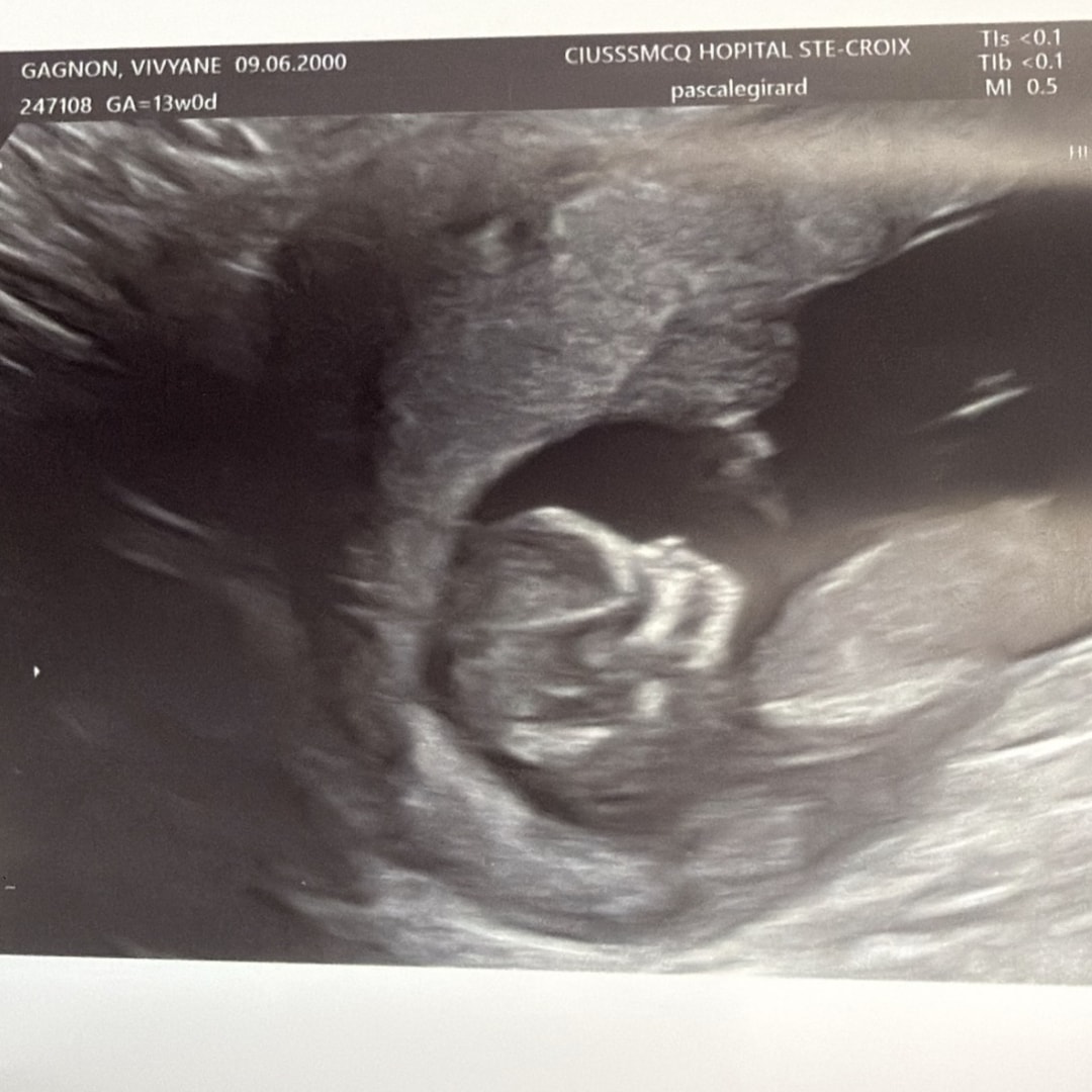 Photo shared by Vivyane for their Babylist baby registry.
