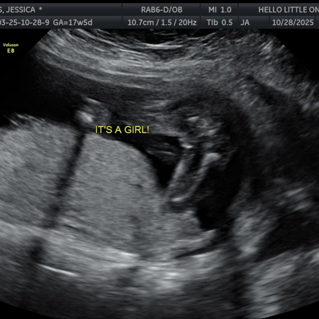 Photo shared by Jessica for their Babylist baby registry.