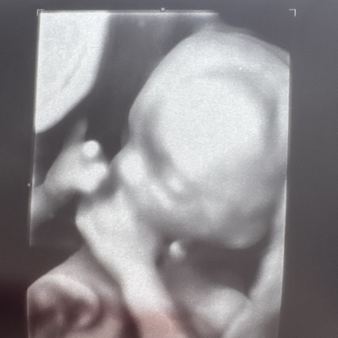 Photo shared by Becca for their Babylist baby registry.