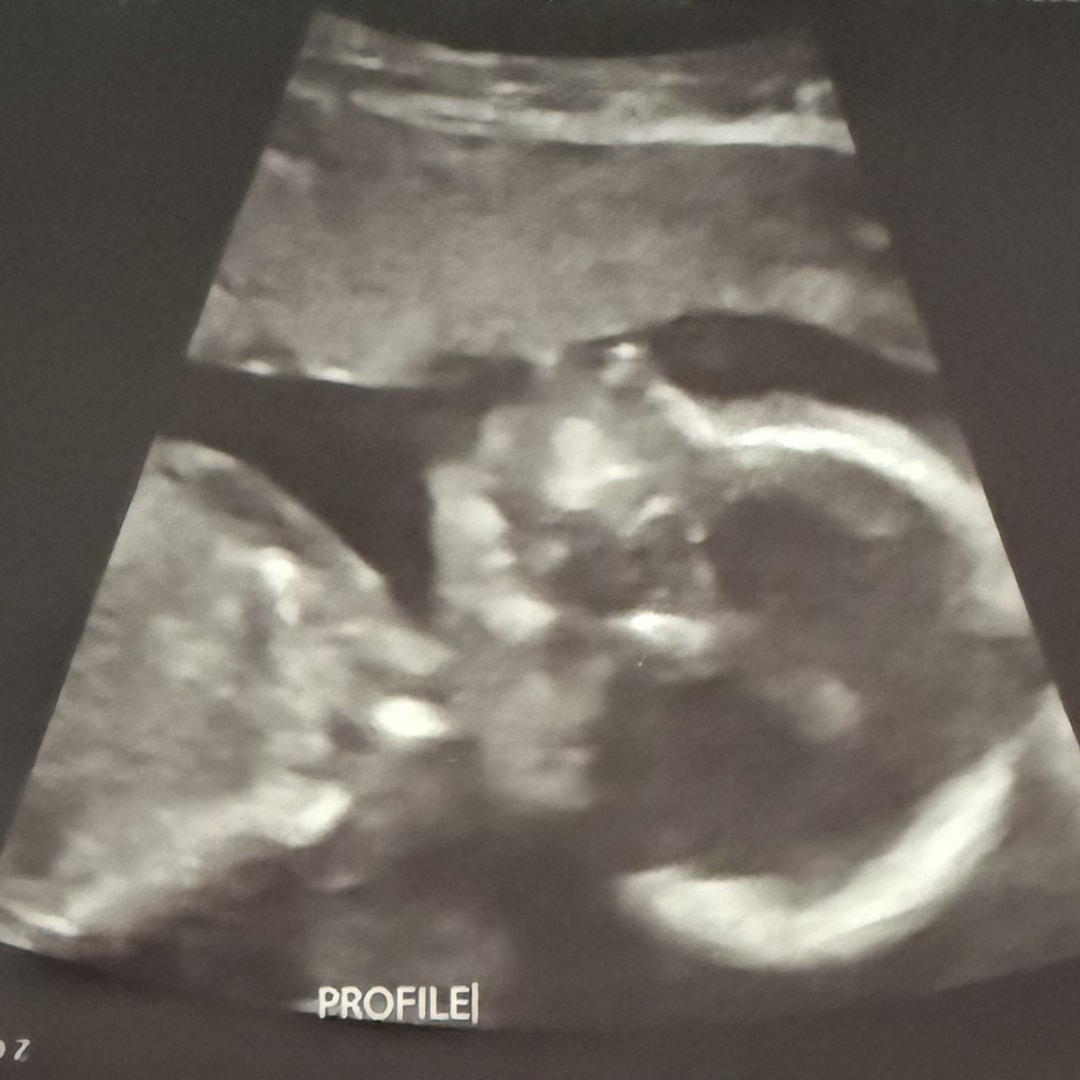 Photo shared by Erikah for their Babylist baby registry.