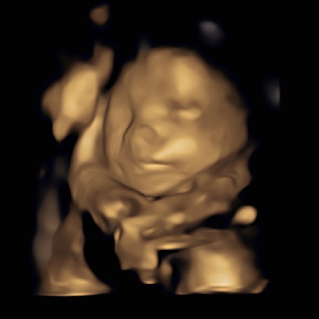 Photo shared by Stephanie for their Babylist baby registry.