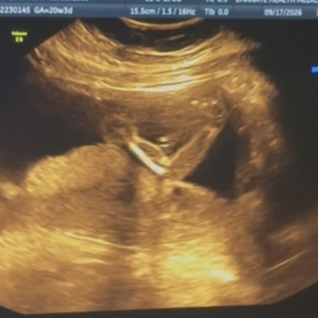 Photo shared by Jennifer for their Babylist baby registry.