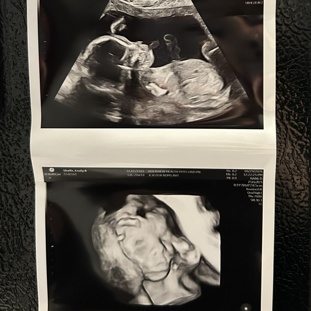 Photo shared by Emily for their Babylist baby registry.