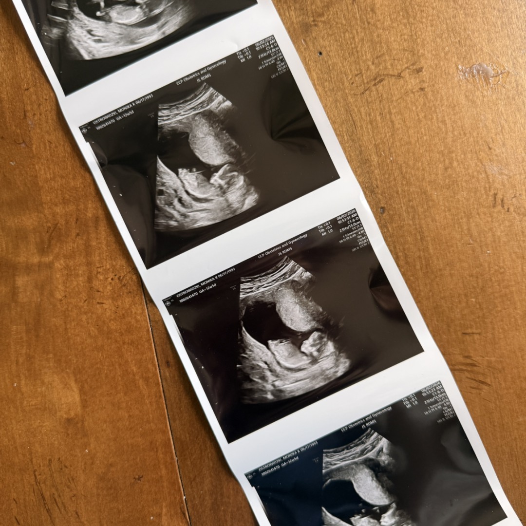 Photo shared by Monika for their Babylist baby registry.