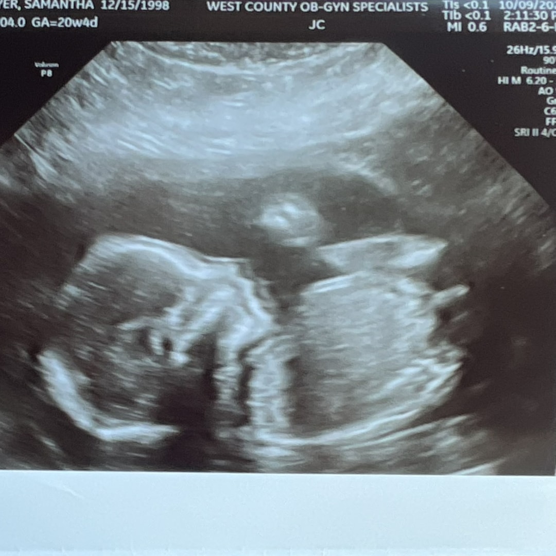 Photo shared by Samantha for their Babylist baby registry.