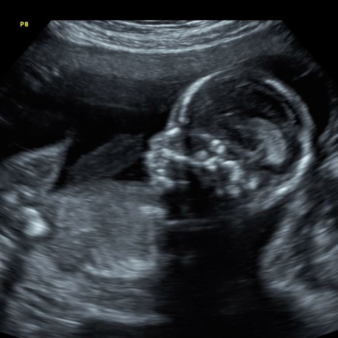 Photo shared by Laurel for their Babylist baby registry.