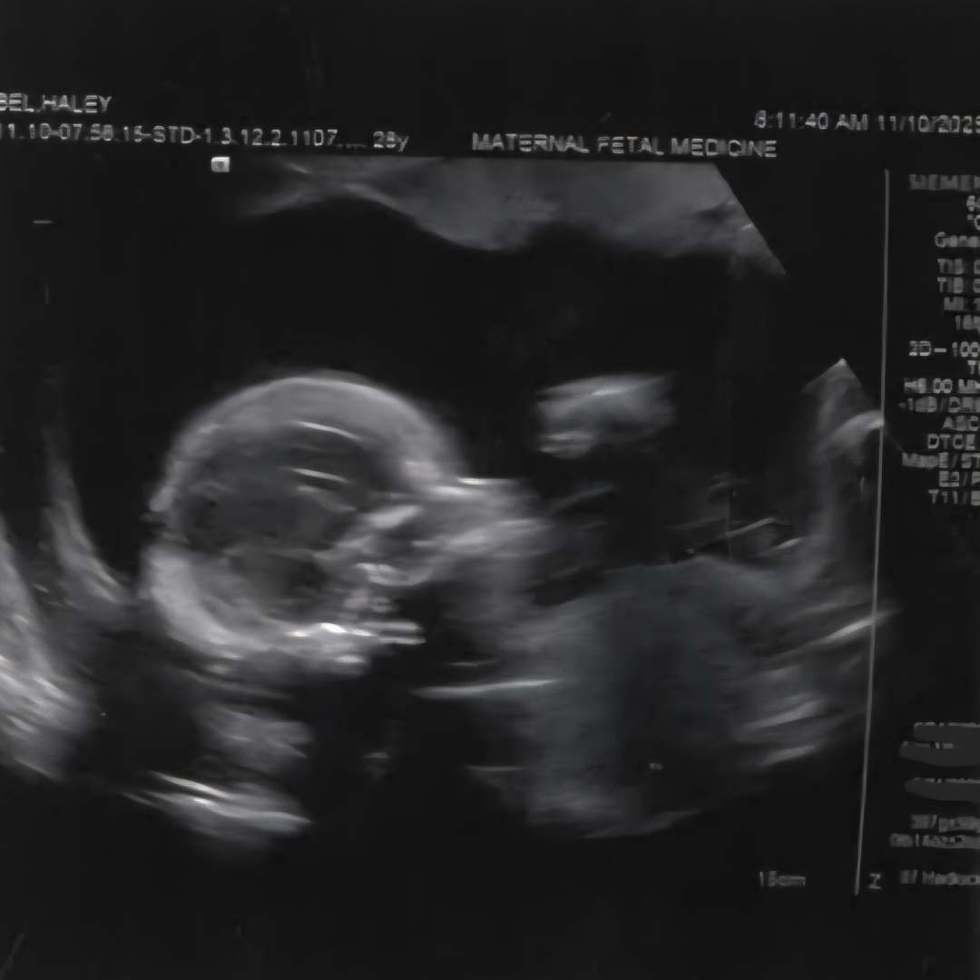 Photo shared by Haley for their Babylist baby registry.