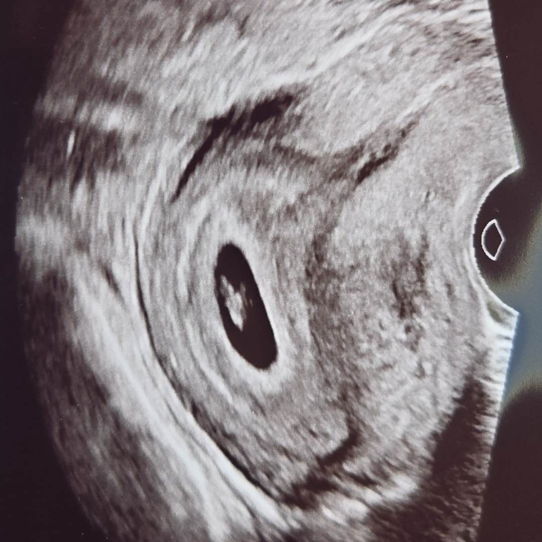 Photo shared by Mahlia for their Babylist baby registry.
