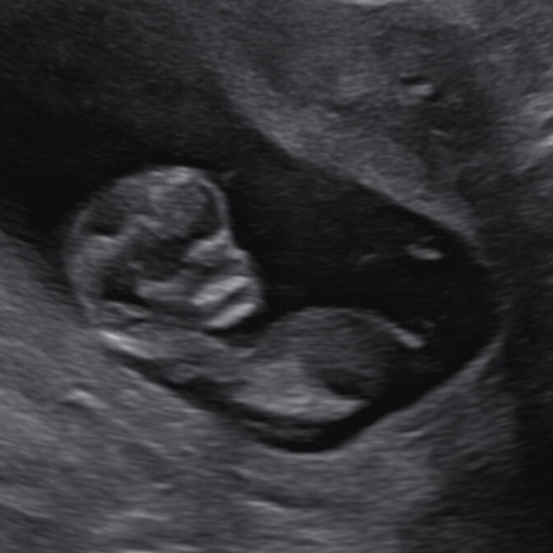 Photo shared by Jenna for their Babylist baby registry.