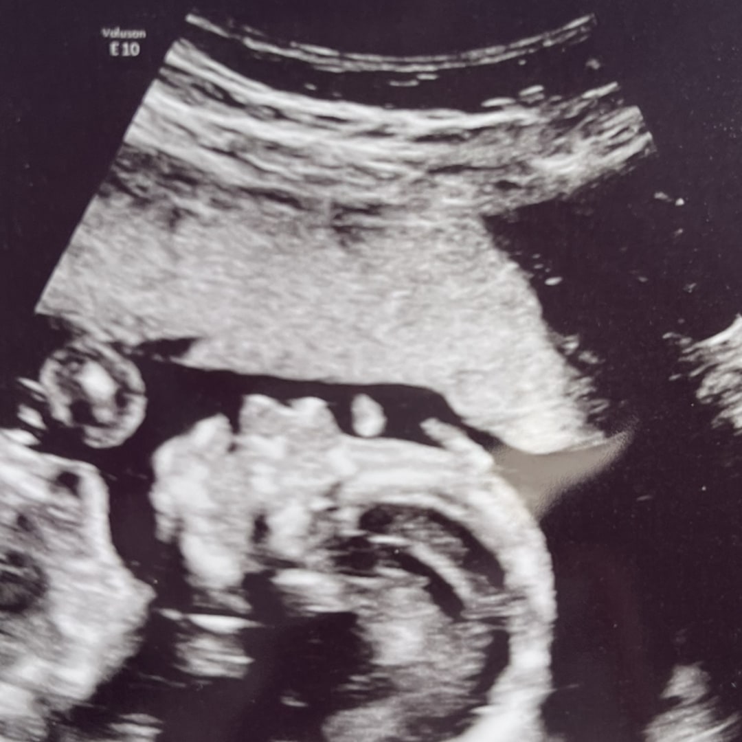 Photo shared by Rachel for their Babylist baby registry.