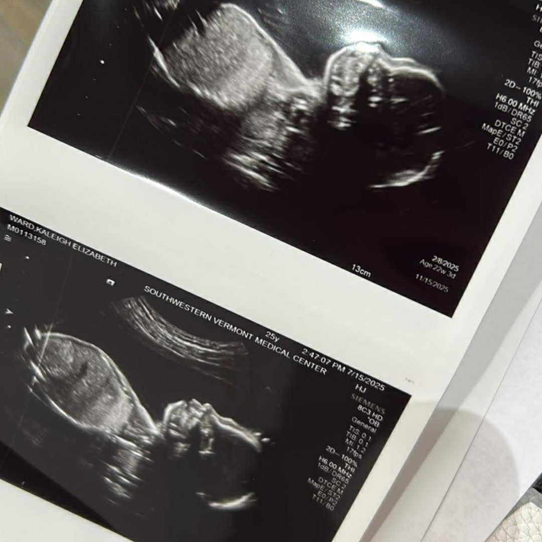 Photo shared by Kaleigh for their Babylist baby registry.