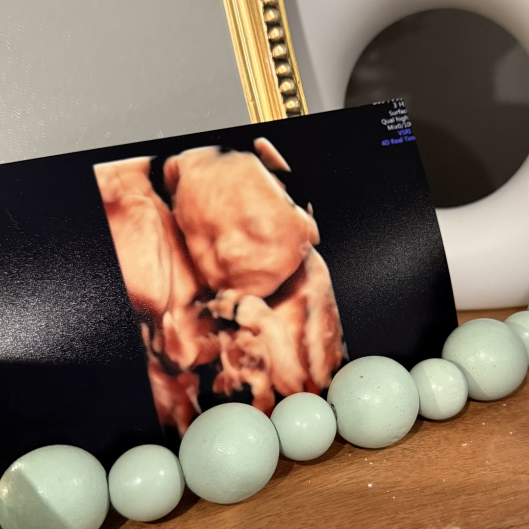 Photo shared by Morgan for their Babylist baby registry.