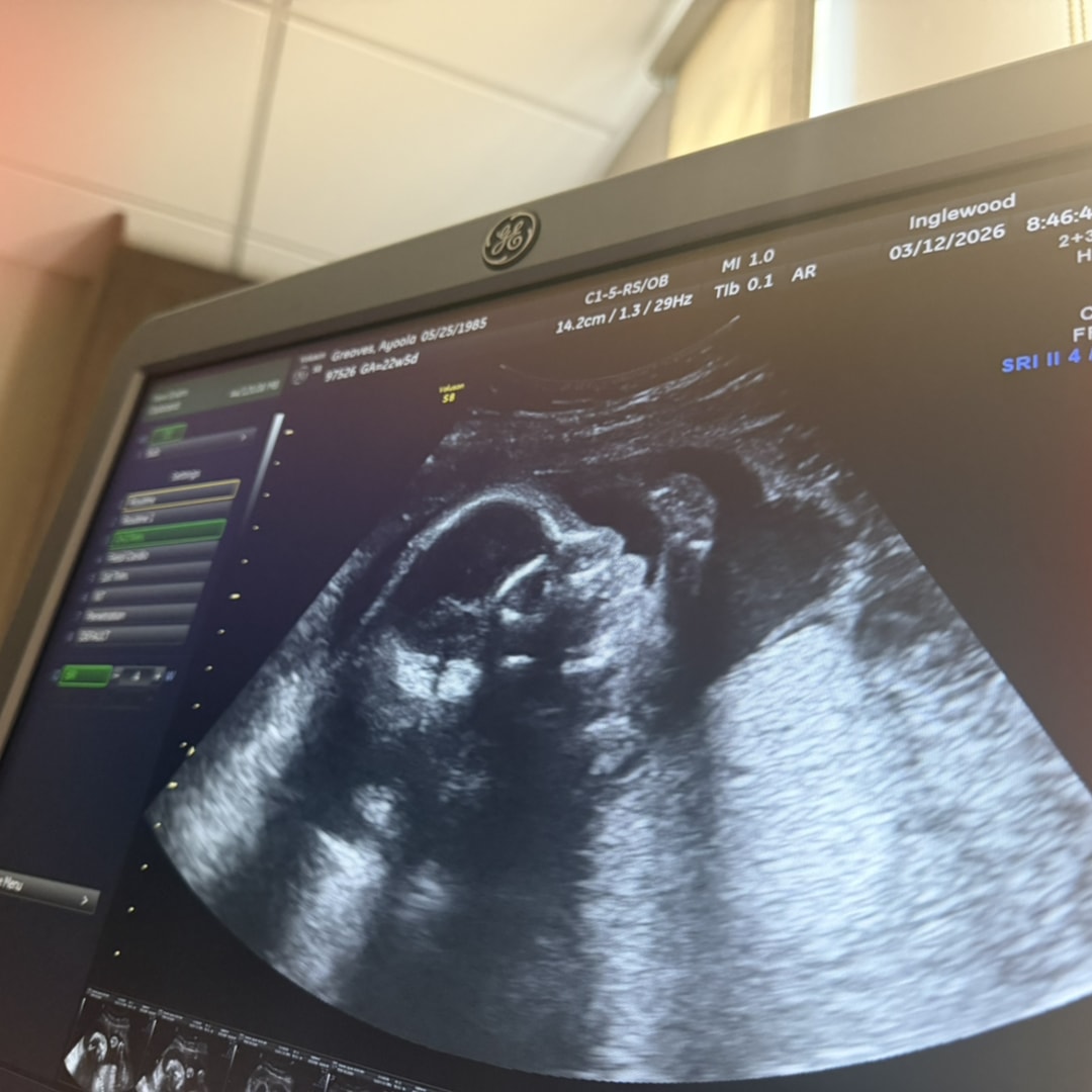 Photo shared by Ayoola for their Babylist baby registry.