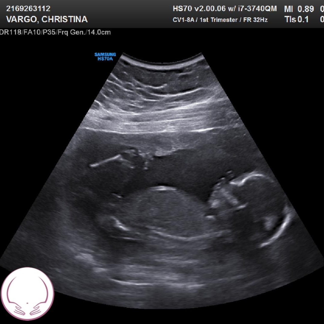 Photo shared by Chrissy for their Babylist baby registry.