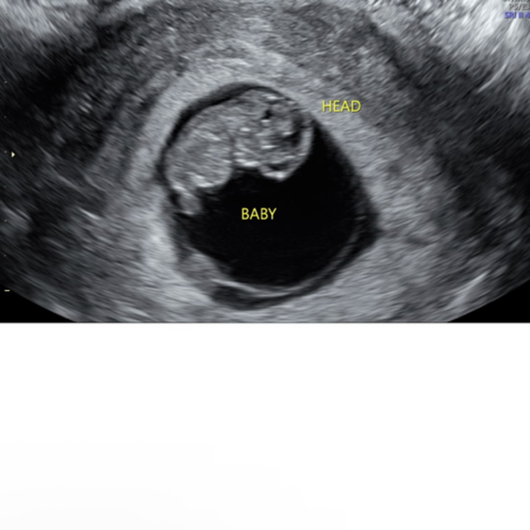 Photo shared by Marissa for their Babylist baby registry.