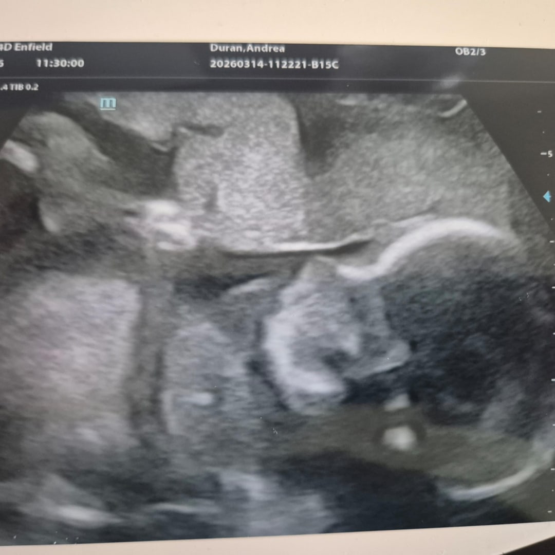 Photo shared by Andrea for their Babylist baby registry.