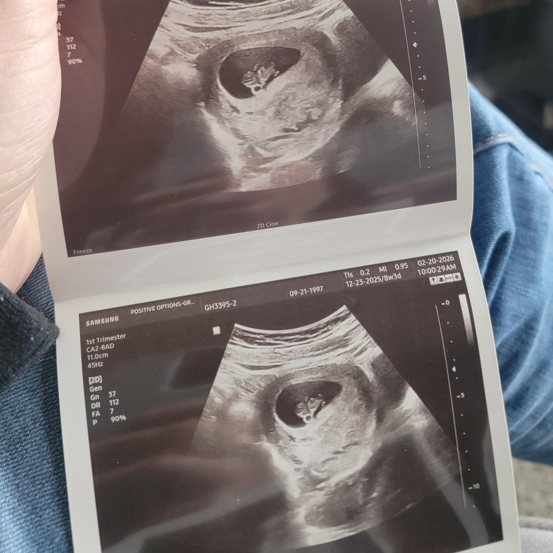 Photo shared by Hanna for their Babylist baby registry.