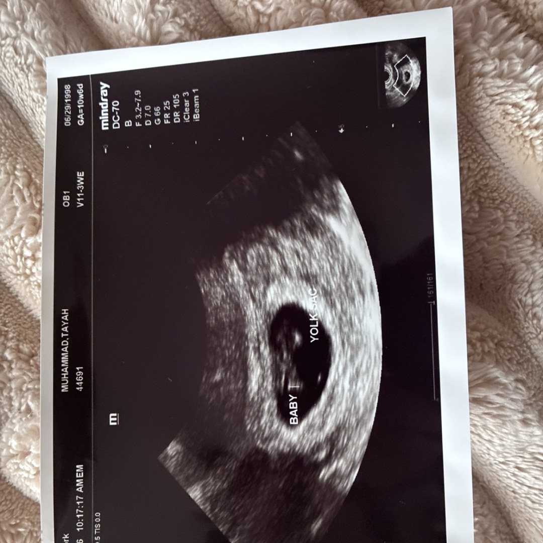 Photo shared by Tayah for their Babylist baby registry.