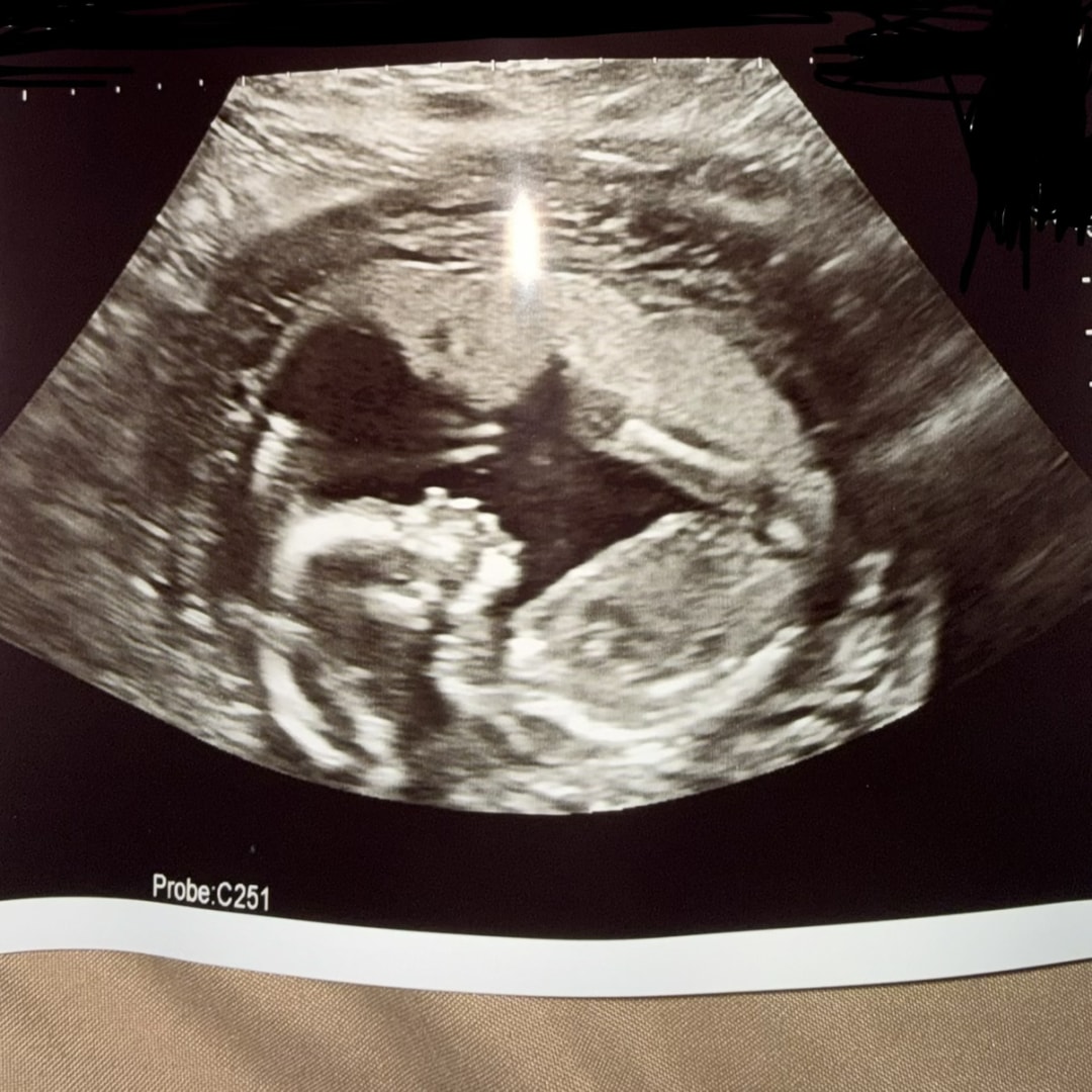 Photo shared by Kayla for their Babylist baby registry.