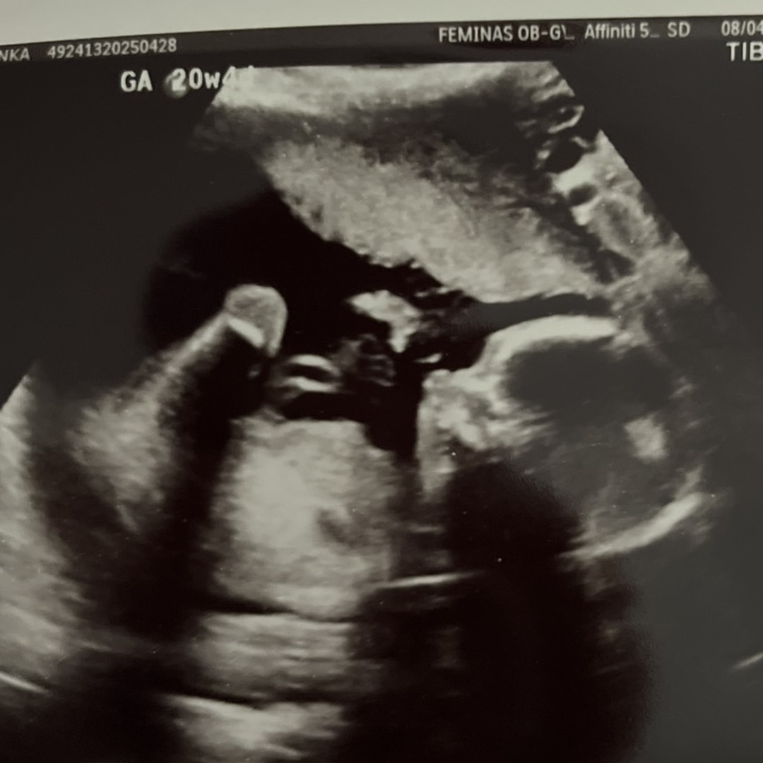 Photo shared by Bianka for their Babylist baby registry.
