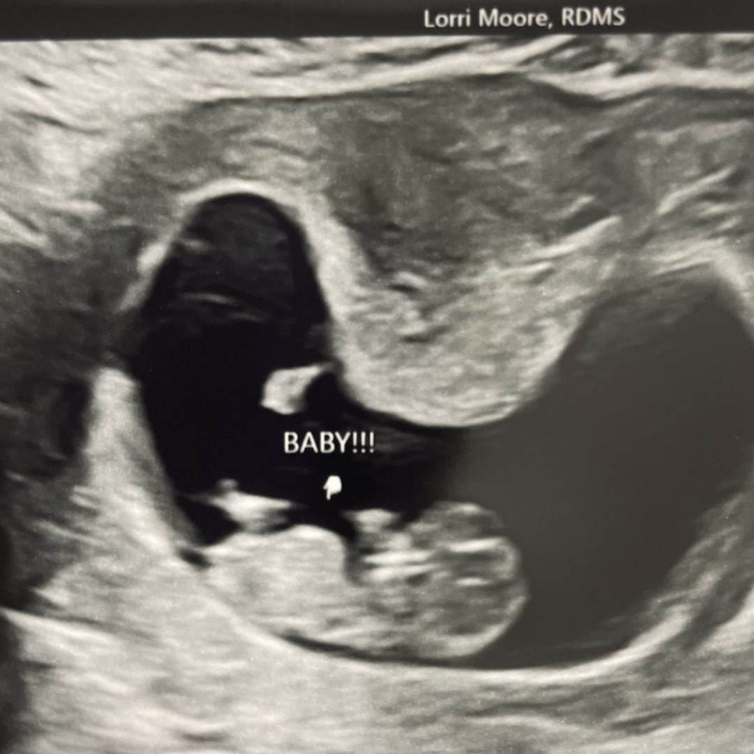 Photo shared by Lauren for their Babylist baby registry.