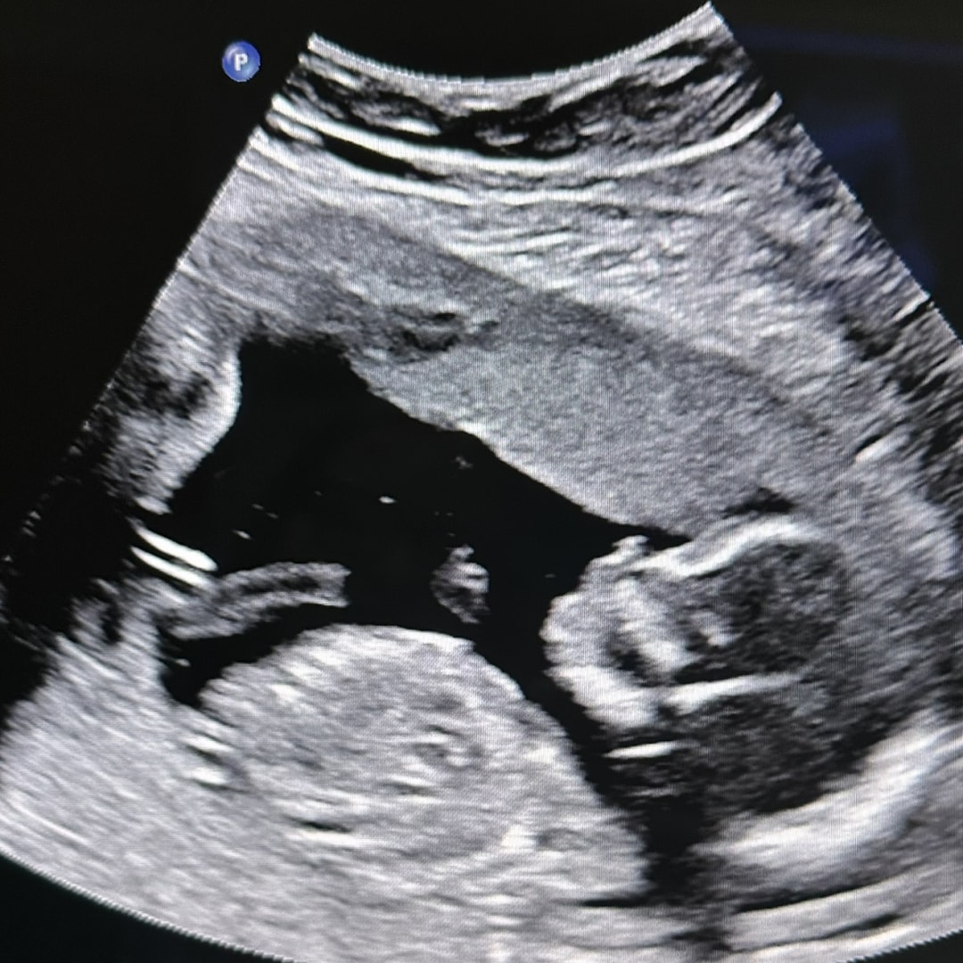 Photo shared by Emily for their Babylist baby registry.