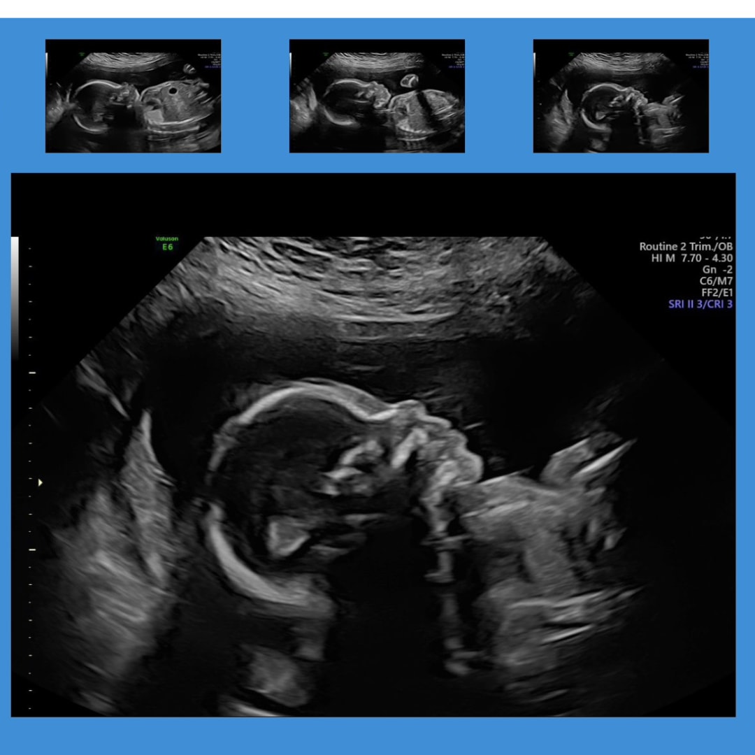 Photo shared by Adrienne for their Babylist baby registry.