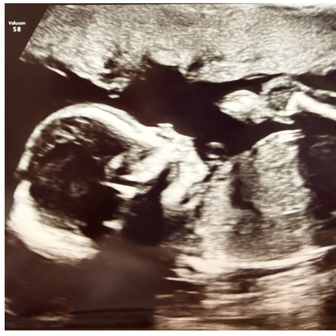 Photo shared by Emma for their Babylist baby registry.