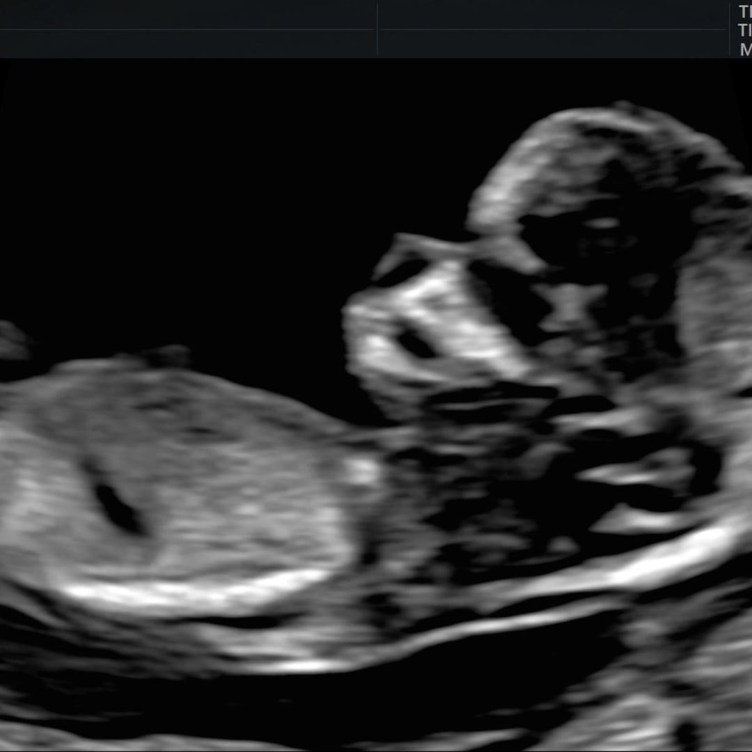 Photo shared by Karen for their Babylist baby registry.