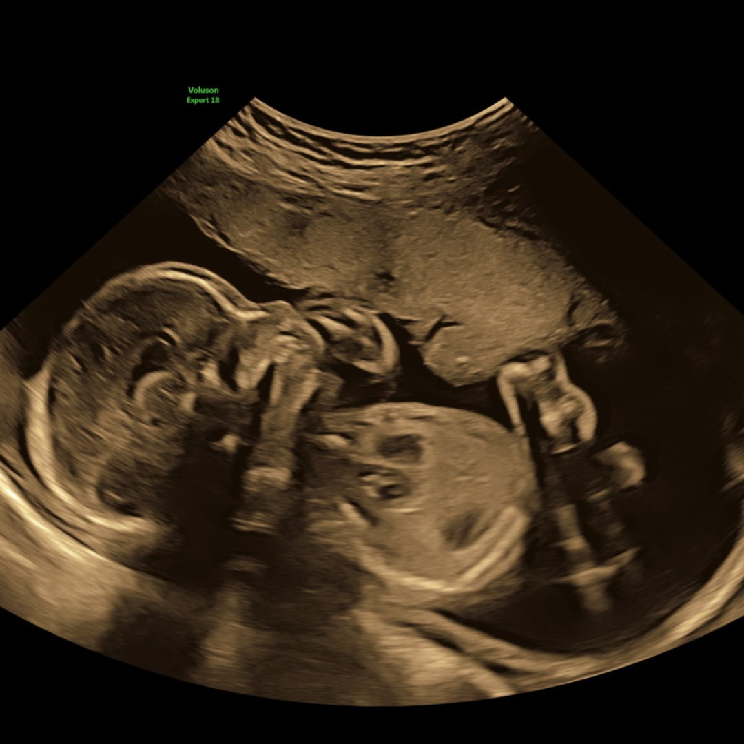 Photo shared by Brionna for their Babylist baby registry.