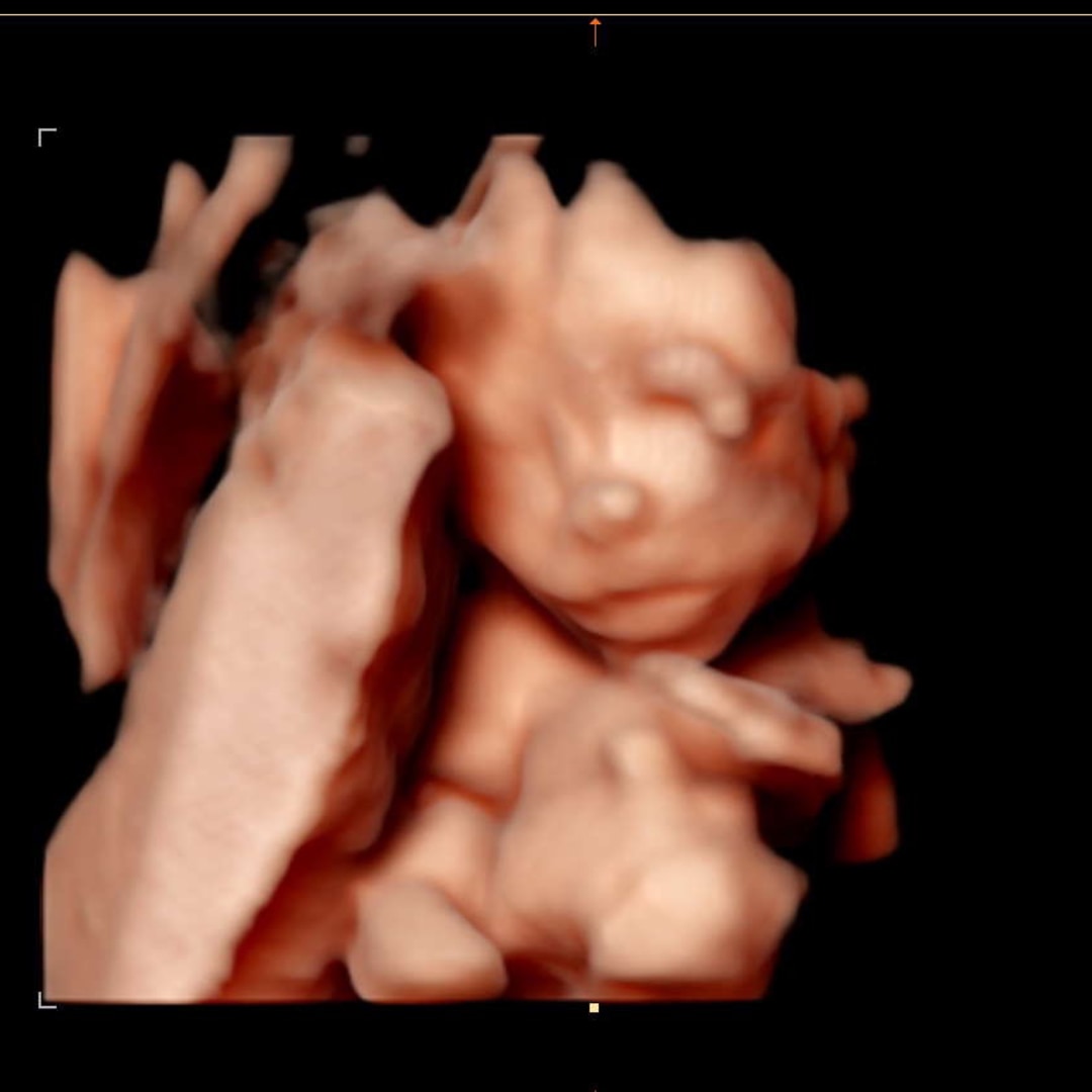 Photo shared by Hannah-Ireland for their Babylist baby registry.