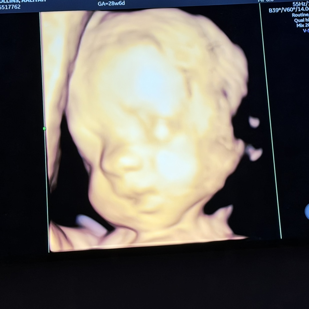 Photo shared by Aaliyah for their Babylist baby registry.