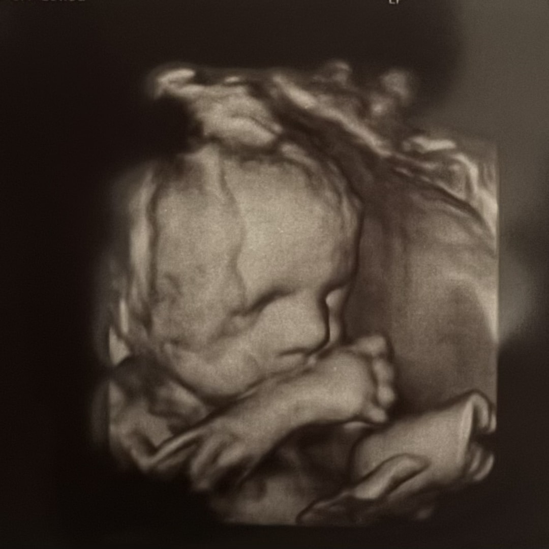Photo shared by Brittany for their Babylist baby registry.