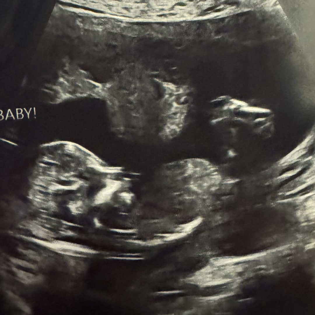 Photo shared by Samantha for their Babylist baby registry.