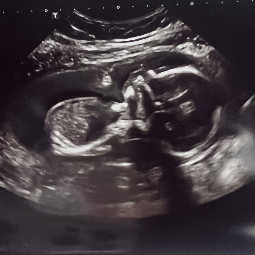 Photo shared by Cristina for their Babylist baby registry.