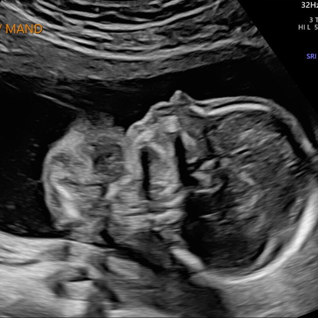 Photo shared by Ashlyn for their Babylist baby registry.