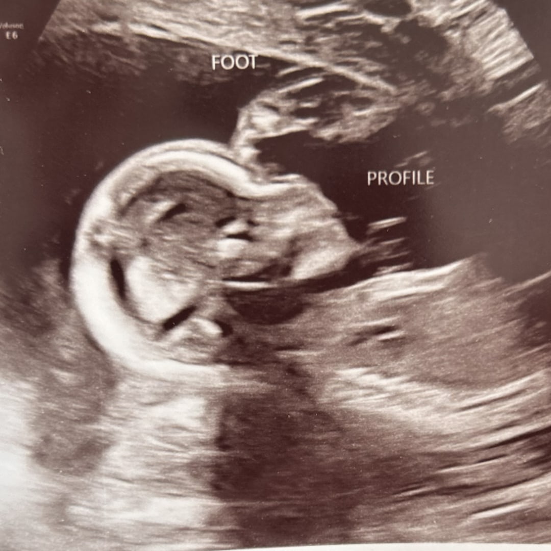 Photo shared by Amber for their Babylist baby registry.