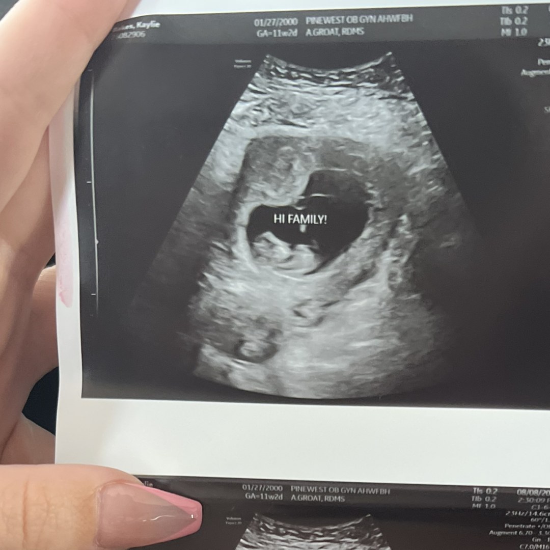 Photo shared by Kaylie for their Babylist baby registry.