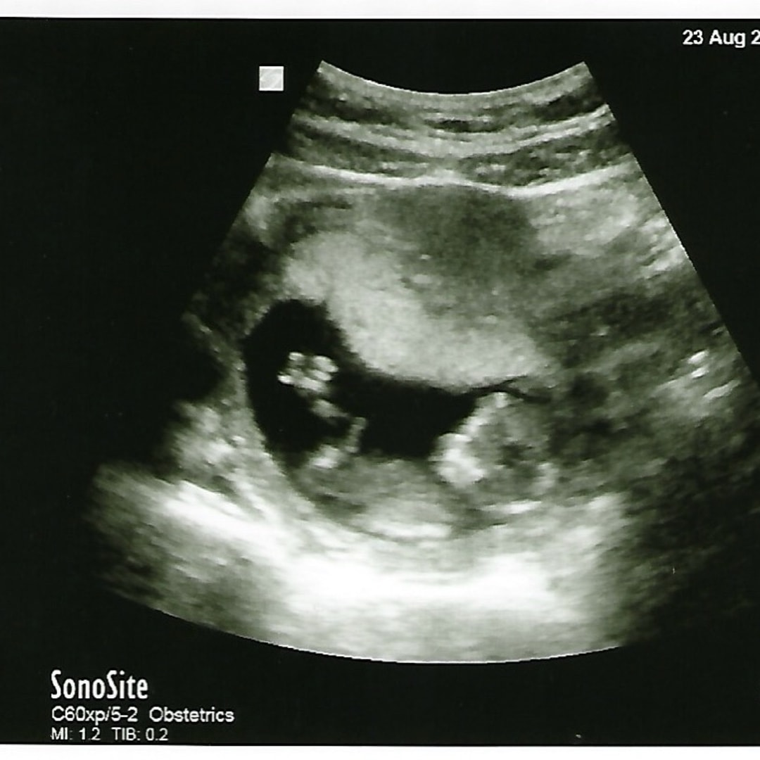 Photo shared by Helen for their Babylist baby registry.