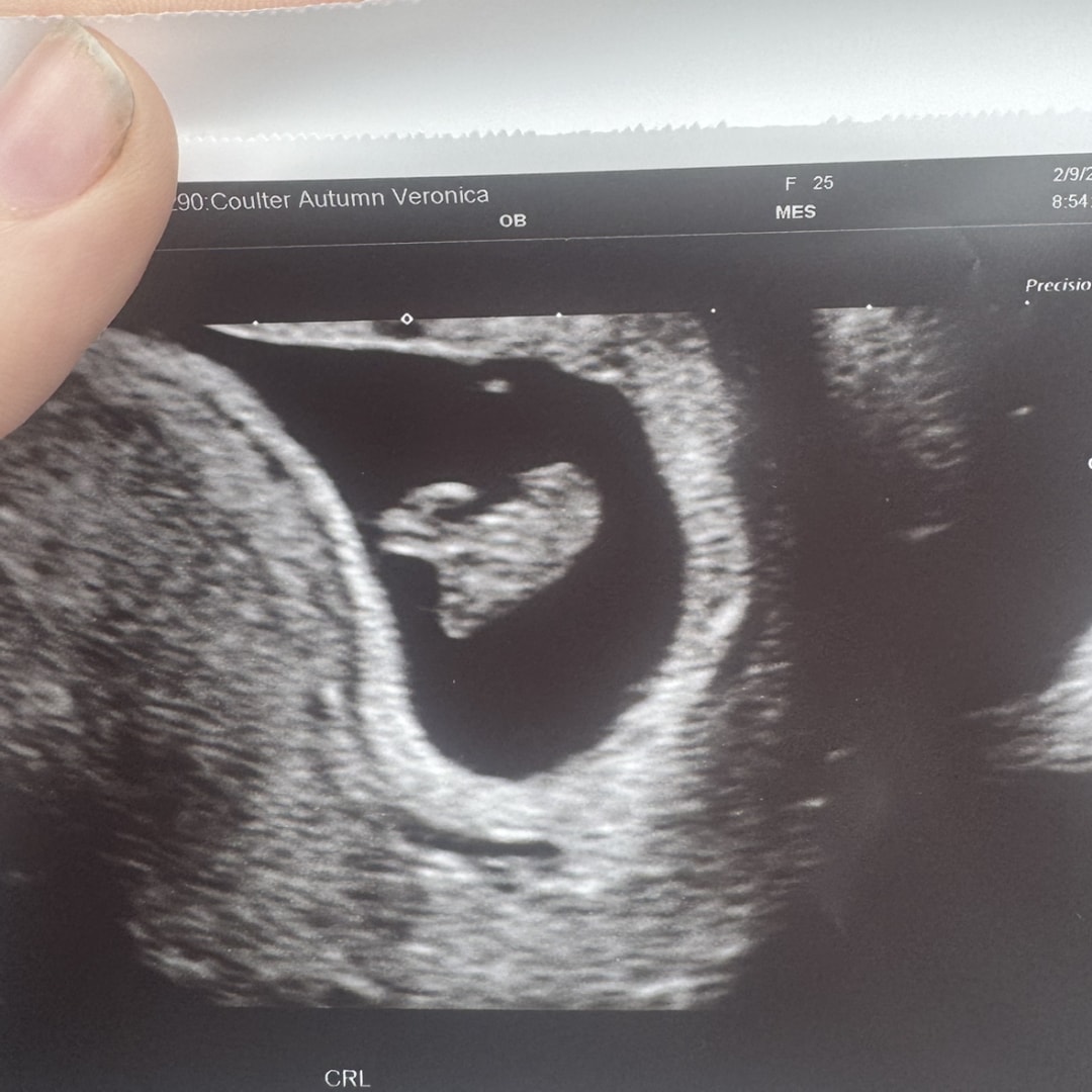 Photo shared by Autumn for their Babylist baby registry.