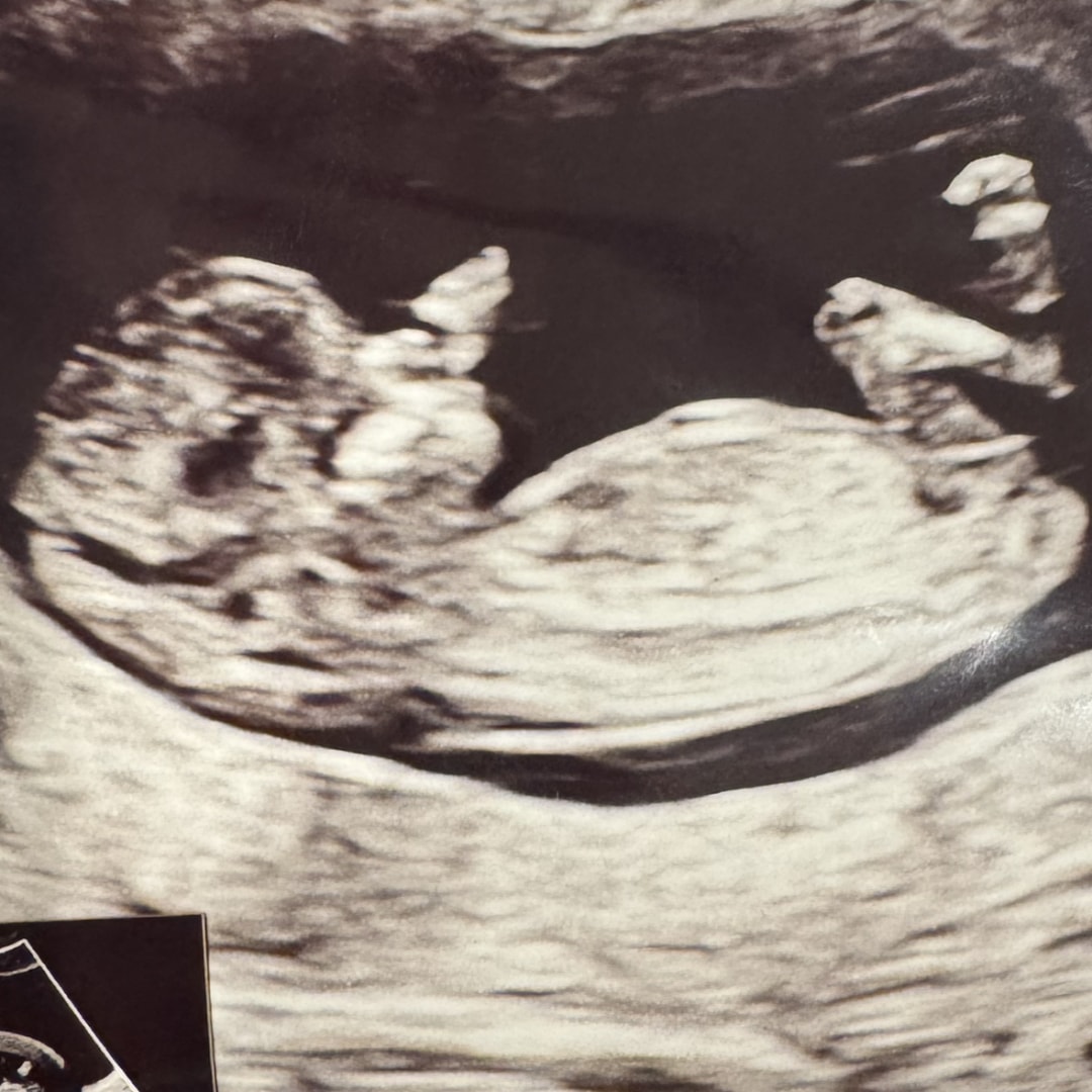 Photo shared by Sierra for their Babylist baby registry.