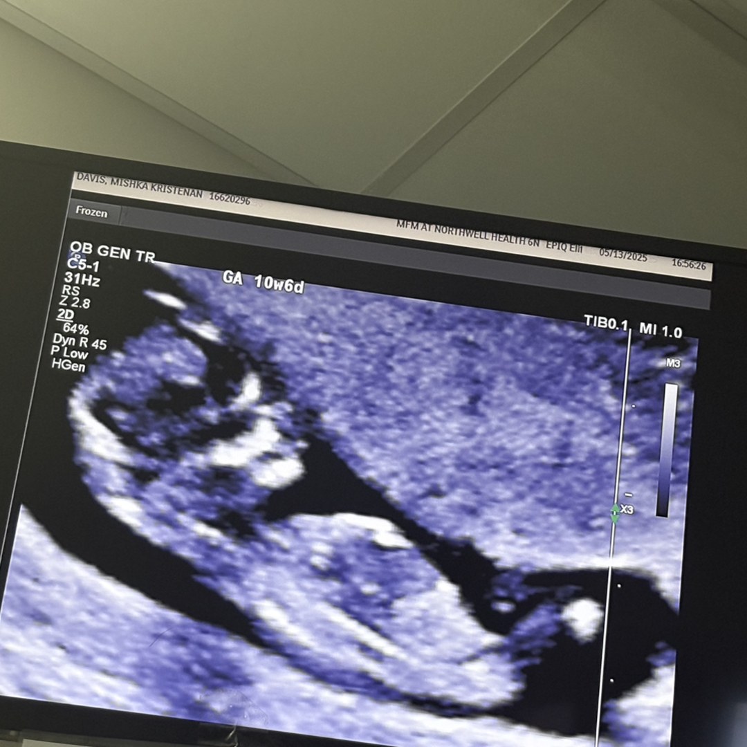 Photo shared by Mishka for their Babylist baby registry.