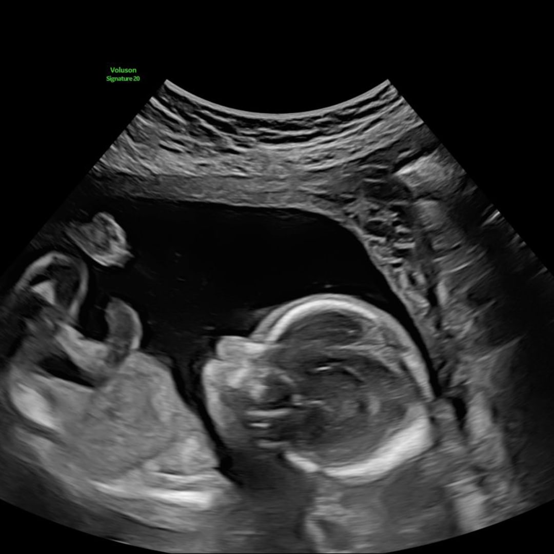 Photo shared by Emily for their Babylist baby registry.