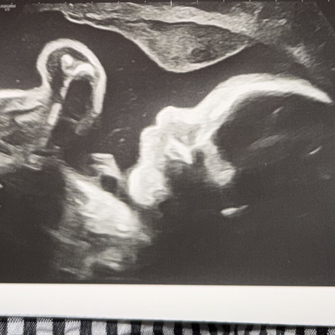 Photo shared by Nicky for their Babylist baby registry.