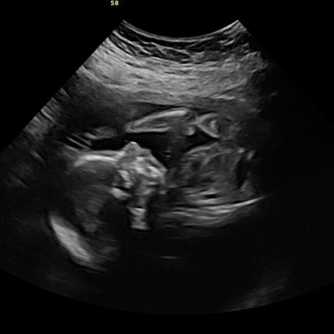 Photo shared by Perla for their Babylist baby registry.