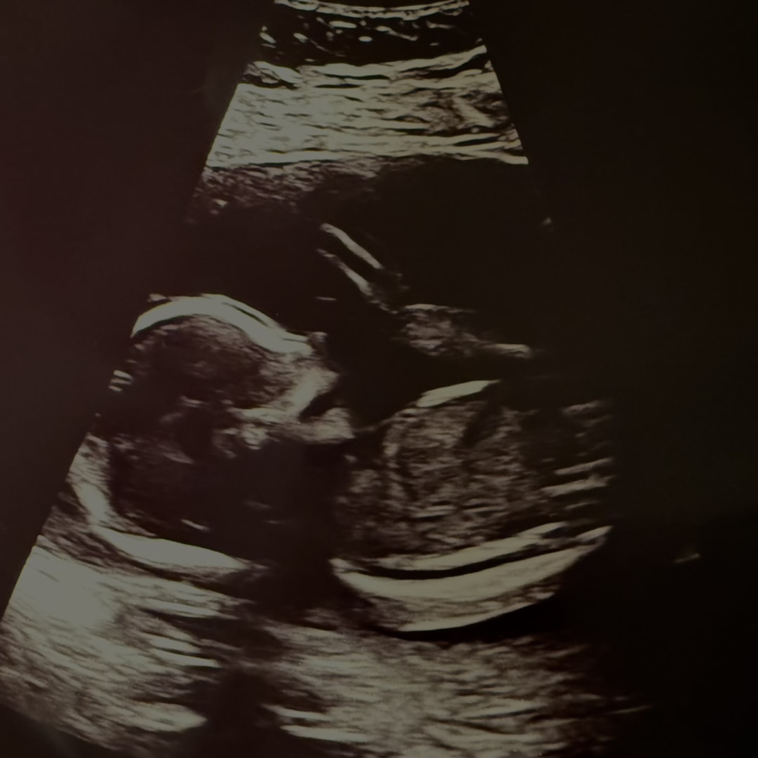 Photo shared by Samantha for their Babylist baby registry.