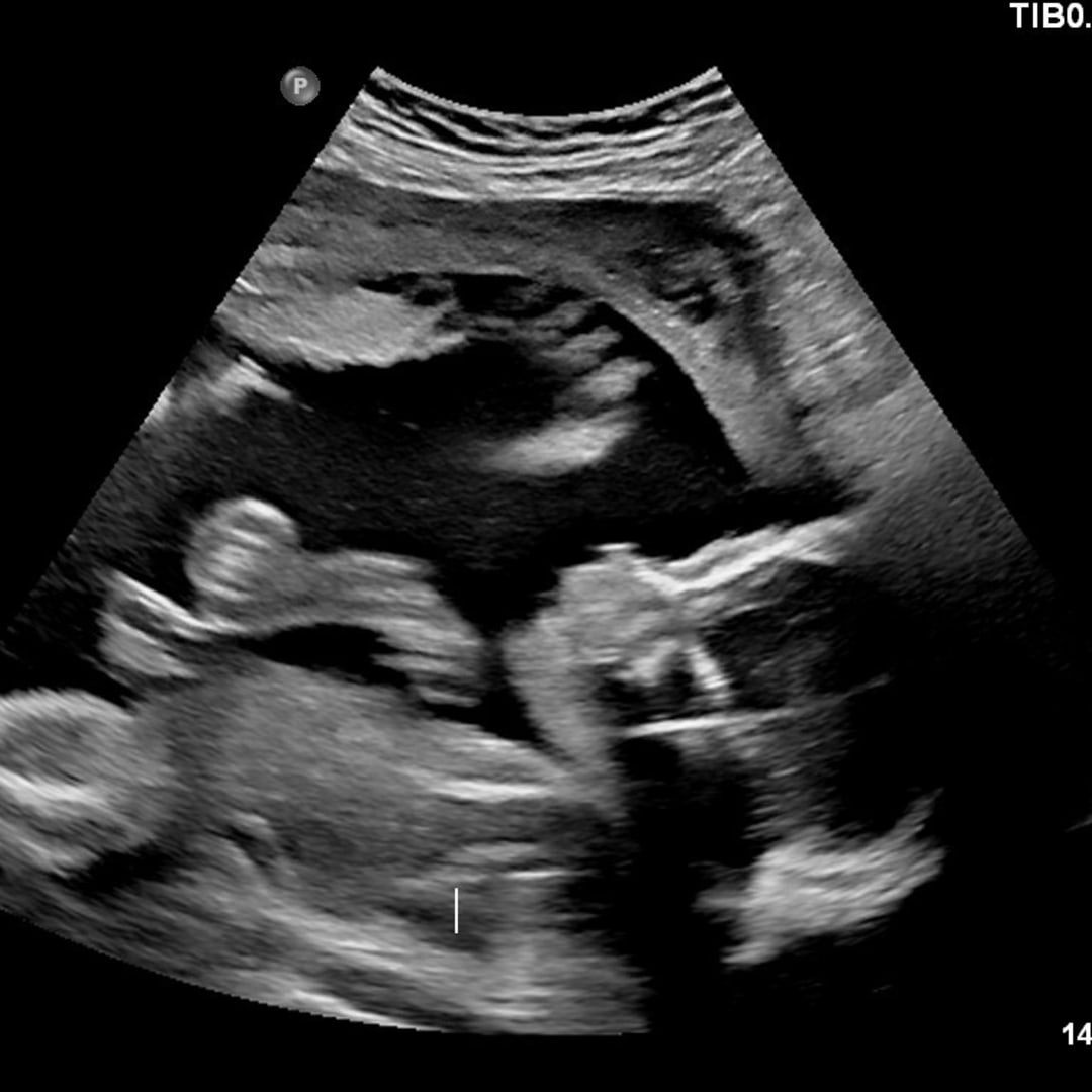 Photo shared by Andrea for their Babylist baby registry.