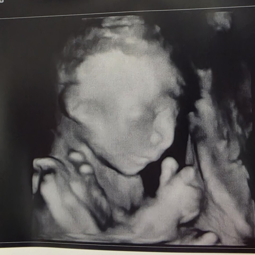 Photo shared by Morgan for their Babylist baby registry.