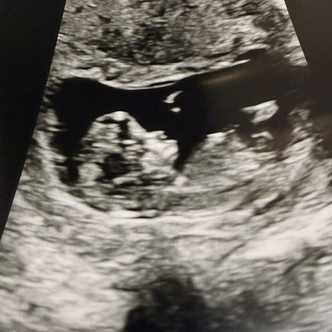 Photo shared by Emilee for their Babylist baby registry.